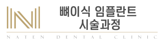 내이튼치과 동탄 치과 진료 이미지