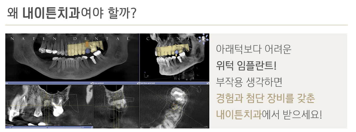 내이튼치과 동탄 치과 진료 이미지