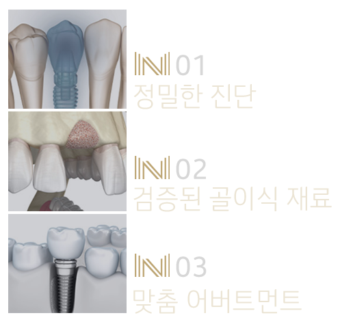 내이튼치과 동탄 치과 진료 이미지