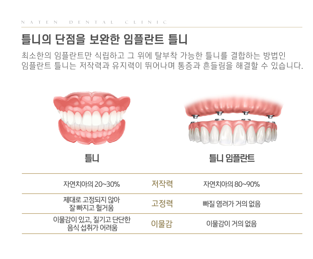 내이튼치과 동탄 치과 진료 이미지