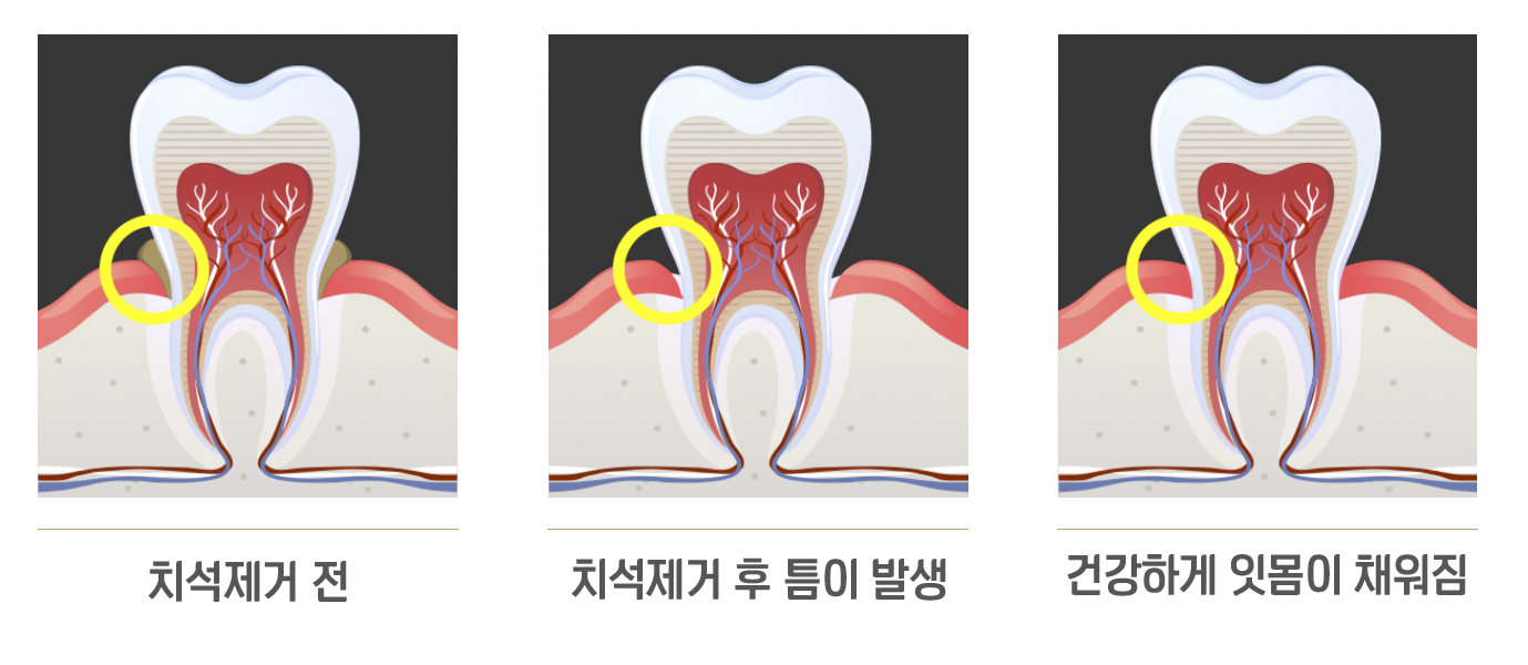 내이튼치과 동탄 치과 진료 이미지