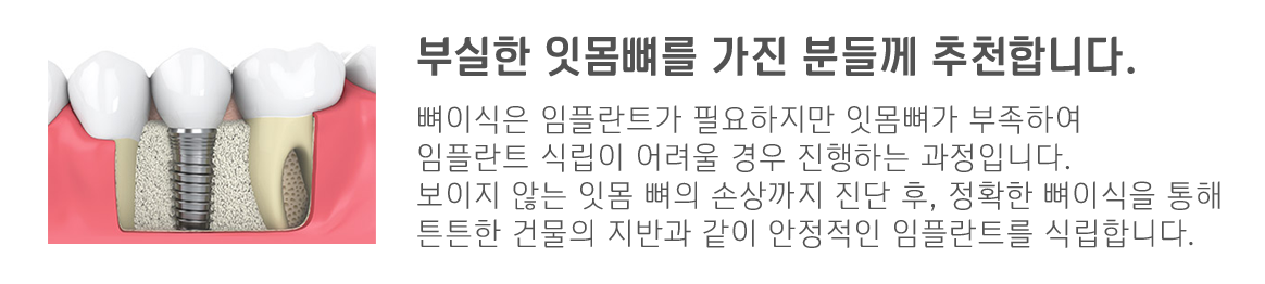 내이튼치과 동탄 치과 진료 이미지