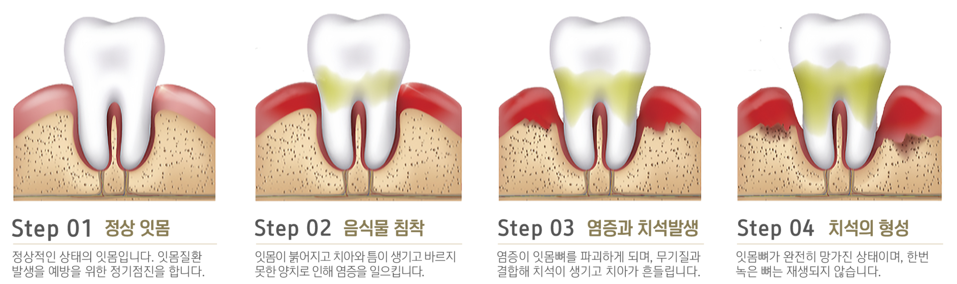 내이튼치과 동탄 치과 진료 이미지