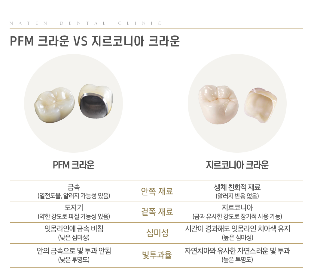 내이튼치과 동탄 치과 진료 이미지