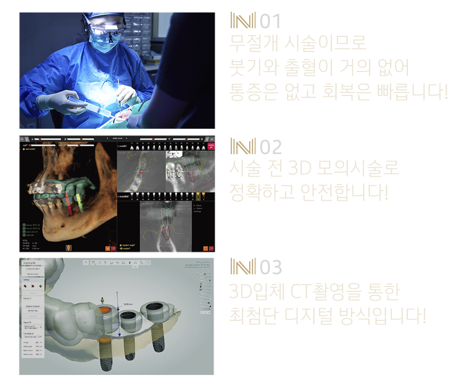 내이튼치과 동탄 치과 진료 이미지