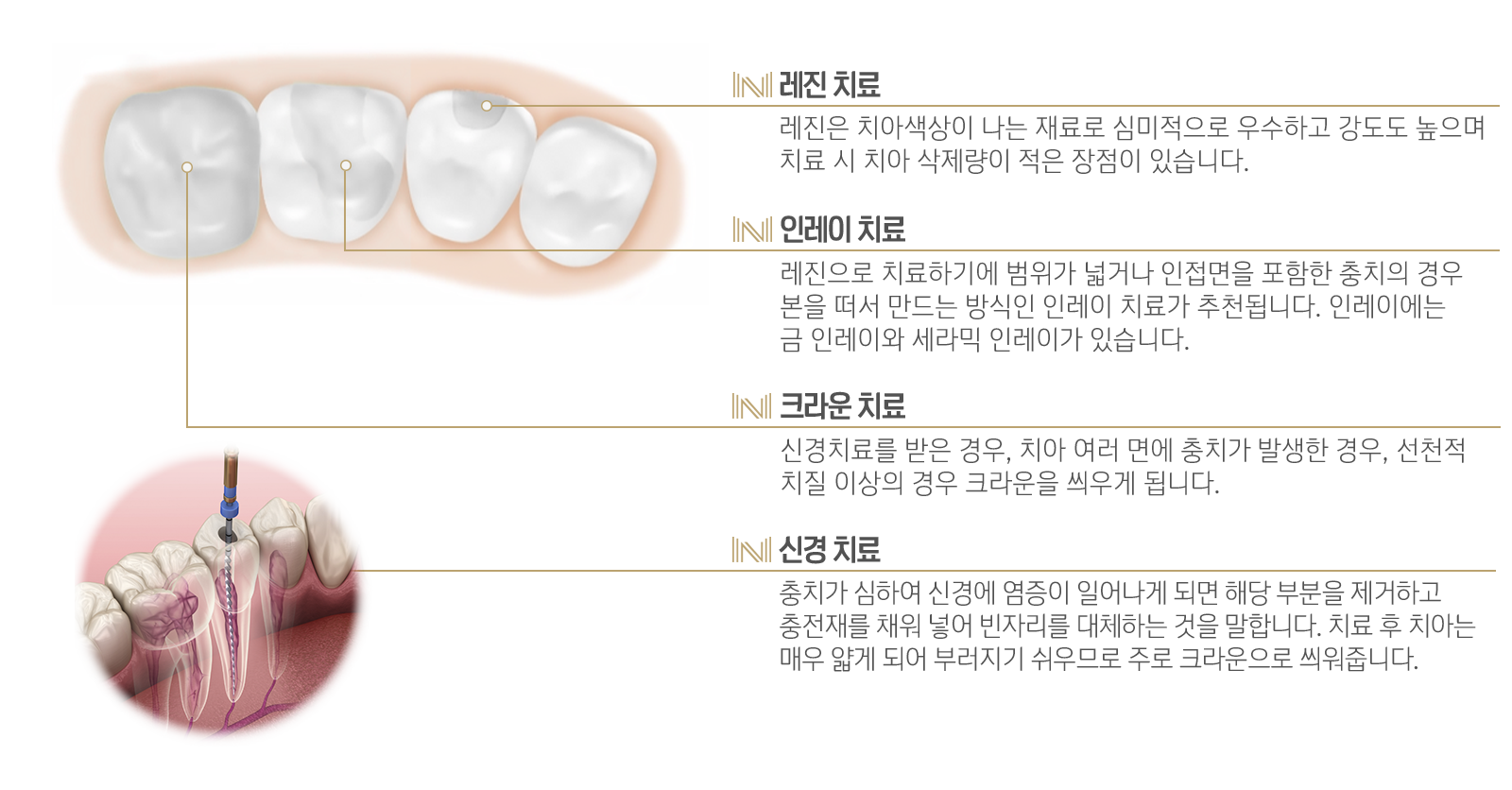 내이튼치과 동탄 치과 진료 이미지