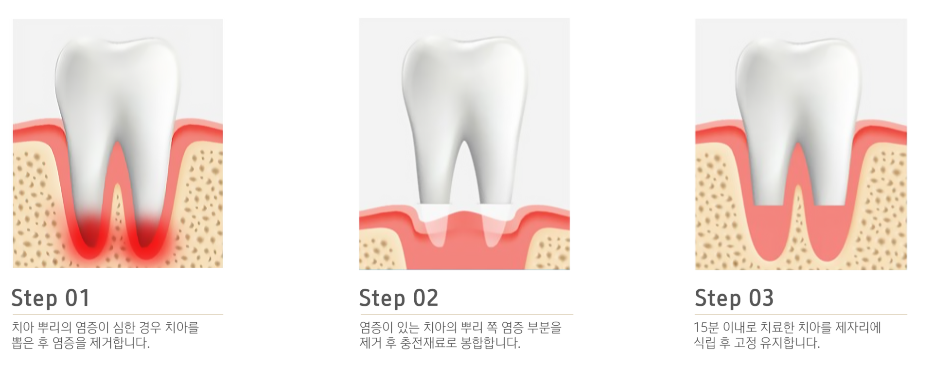 내이튼치과 동탄 치과 진료 이미지
