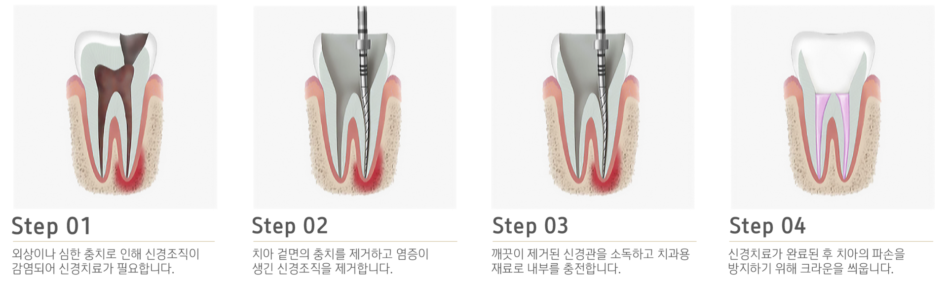 내이튼치과 동탄 치과 진료 이미지