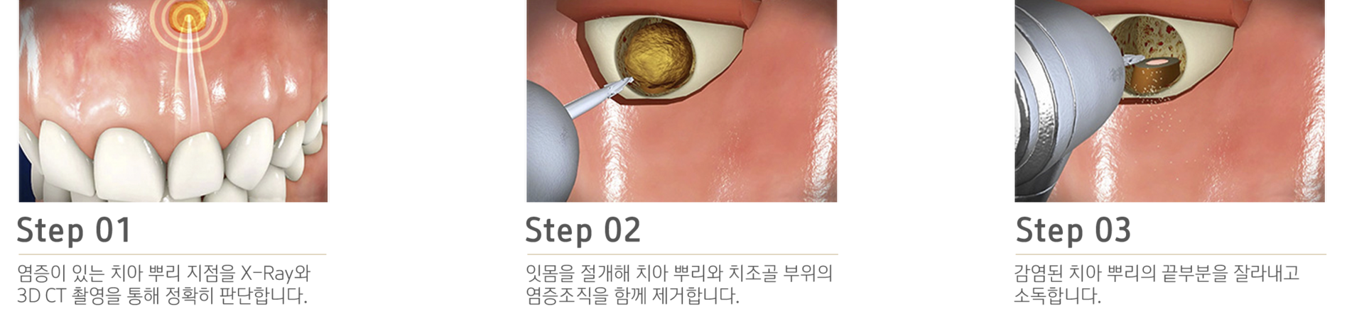 내이튼치과 동탄 치과 진료 이미지