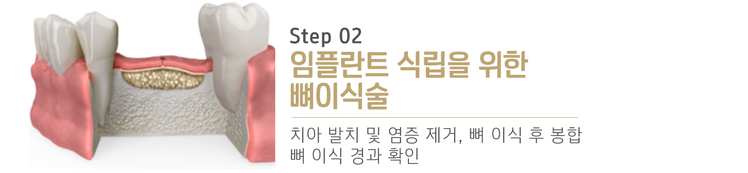 내이튼치과 동탄 치과 진료 이미지