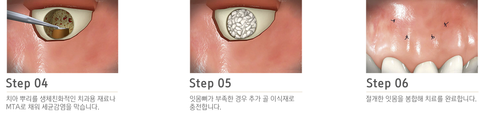 내이튼치과 동탄 치과 진료 이미지