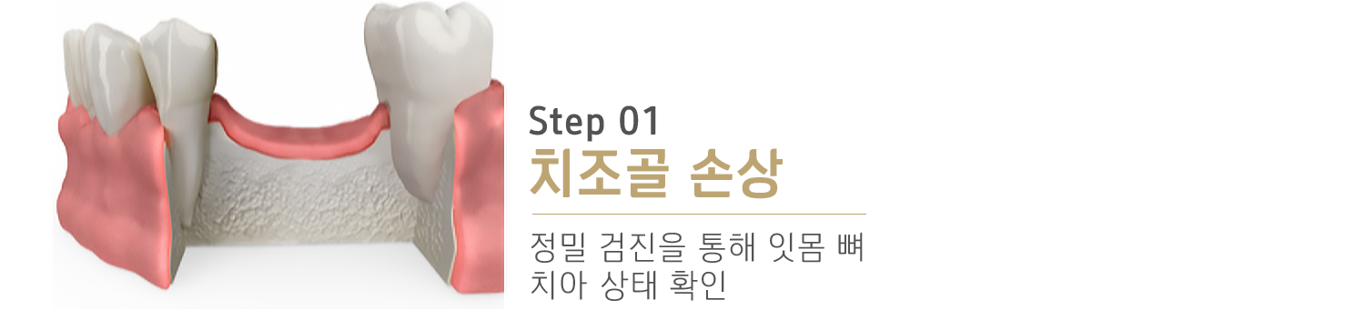 내이튼치과 동탄 치과 진료 이미지