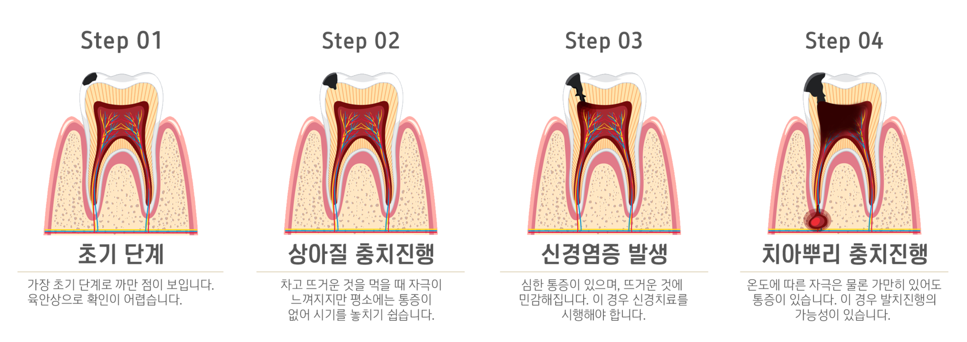 내이튼치과 동탄 치과 진료 이미지